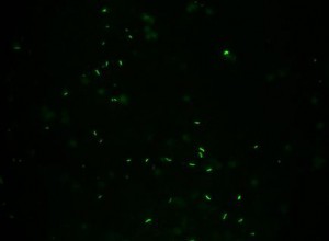 The mycobacteria will appear as bright luminous rods on a dark background. A potassium permanganate counterstain helps prevent non-specific fluorescence. 